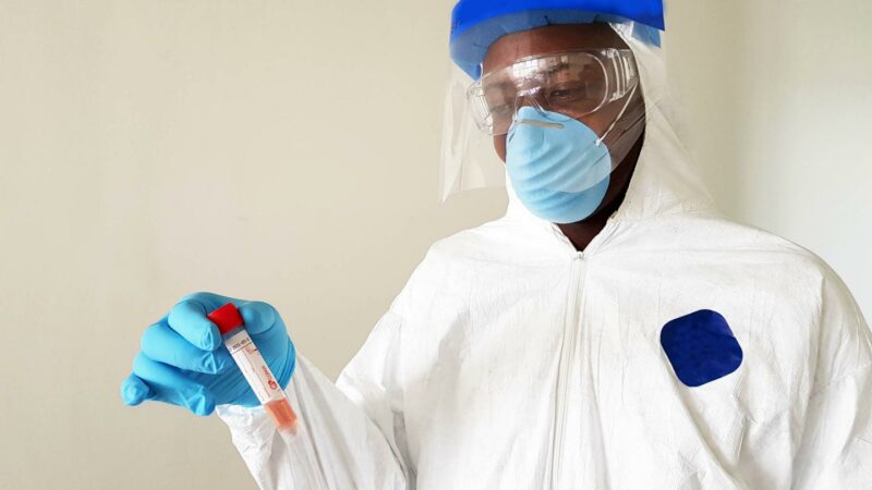 Coronavirus: légère augmentation de cas au Gabon  en 48 heures