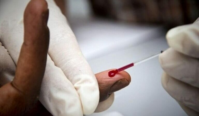 Gabon : 930 décès dus au VIH SIDA en 2020 !