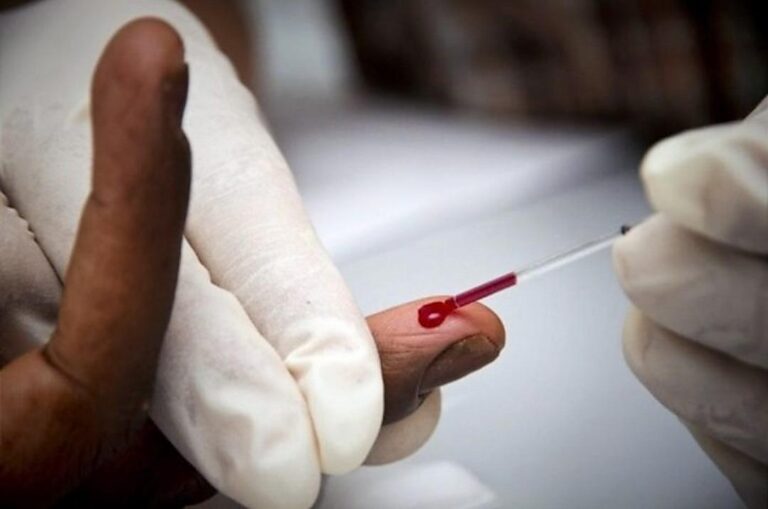 Gabon : 930 décès dus au VIH SIDA en 2020 !